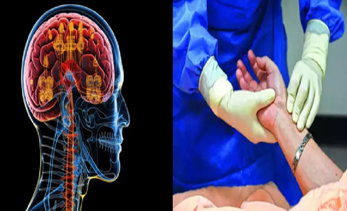 Guillain Barre Syndrome: गुलेन बैरे सिंड्रोम ने बढ़ाई चिंता, बंगाल में चार दिन में 3 की मौत!