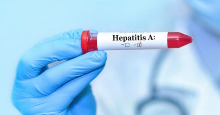 hepatitis-a-in-kerala